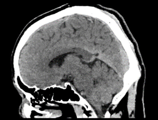 half-second-full-brain