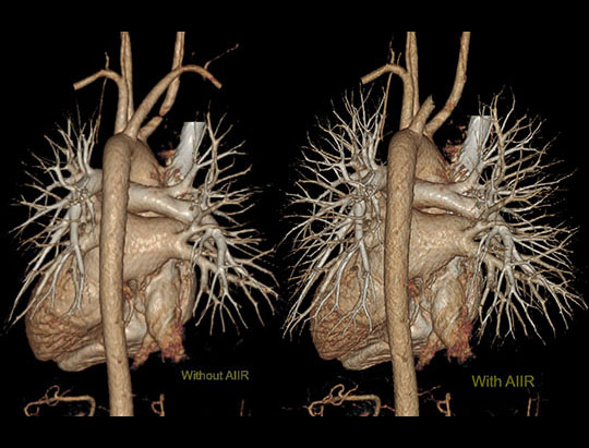masterful_image_reconstruction_540x411