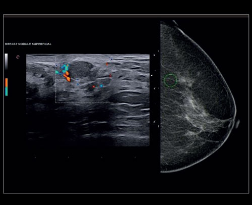 mylabx8-bodymap