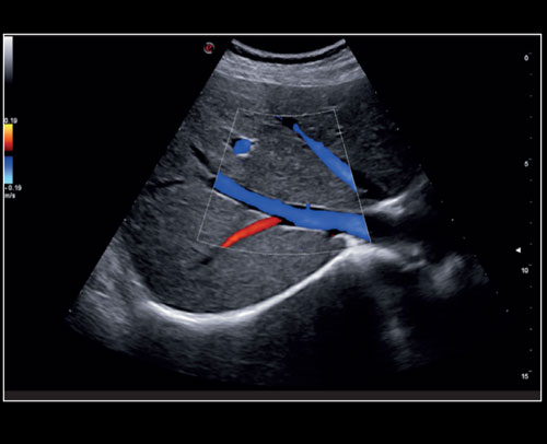 mylabx8-cpi-color-doppler