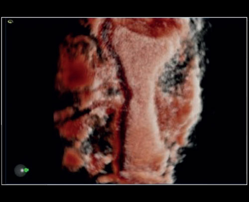 mylabx8-xlight3d-4d